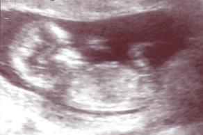 baby scan.jpg